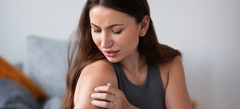 A woman looking at her skin rash on her shoulder